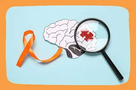 Disease Progression Multiple Sclerosis (MS)
