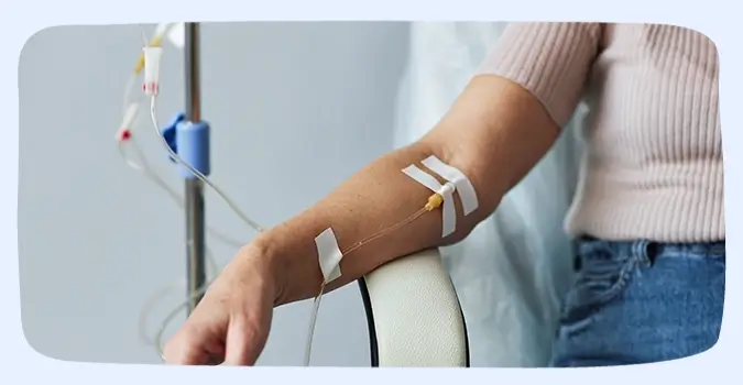 Treatment Multiple Sclerosis (MS)