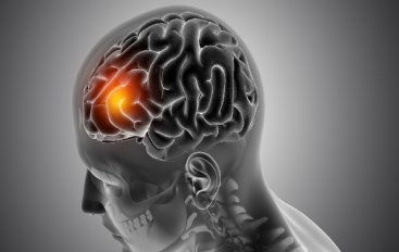 Why Multiple Sclerosis Is Emerging As A Public Health Priority In India